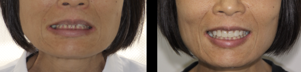 ビフォーアフター